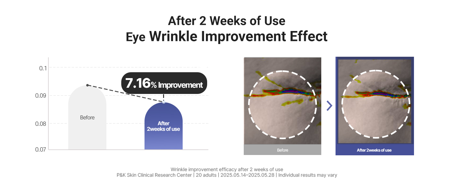Eye Wrinkle Improvement Effect