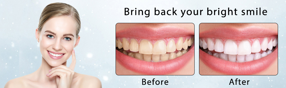 Bring back your bright smile