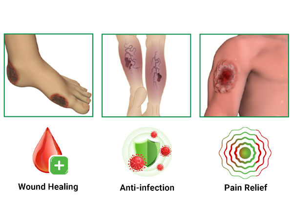 Skin Ulcer Healing Ointment, for Foot &amp; Leg &amp; Varicose &amp; Stasis Ulcers, Sores