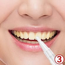 teeth whitening pen