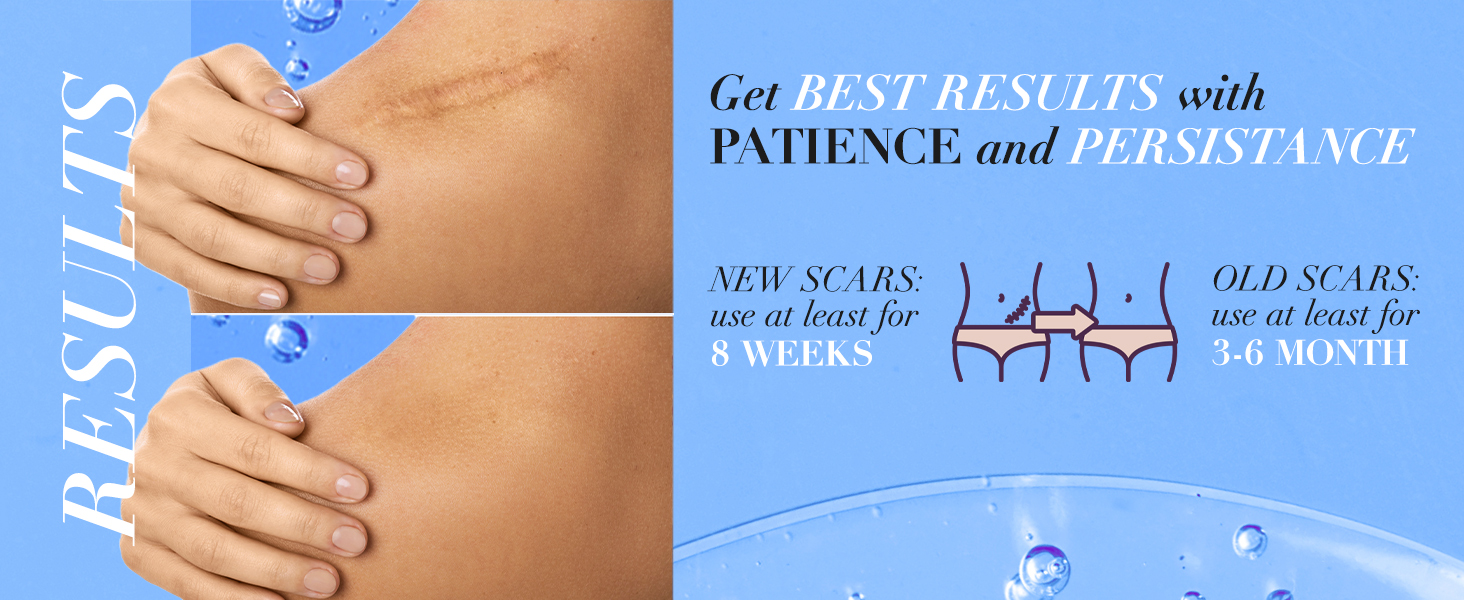 5-in-One Scar Gel : Results