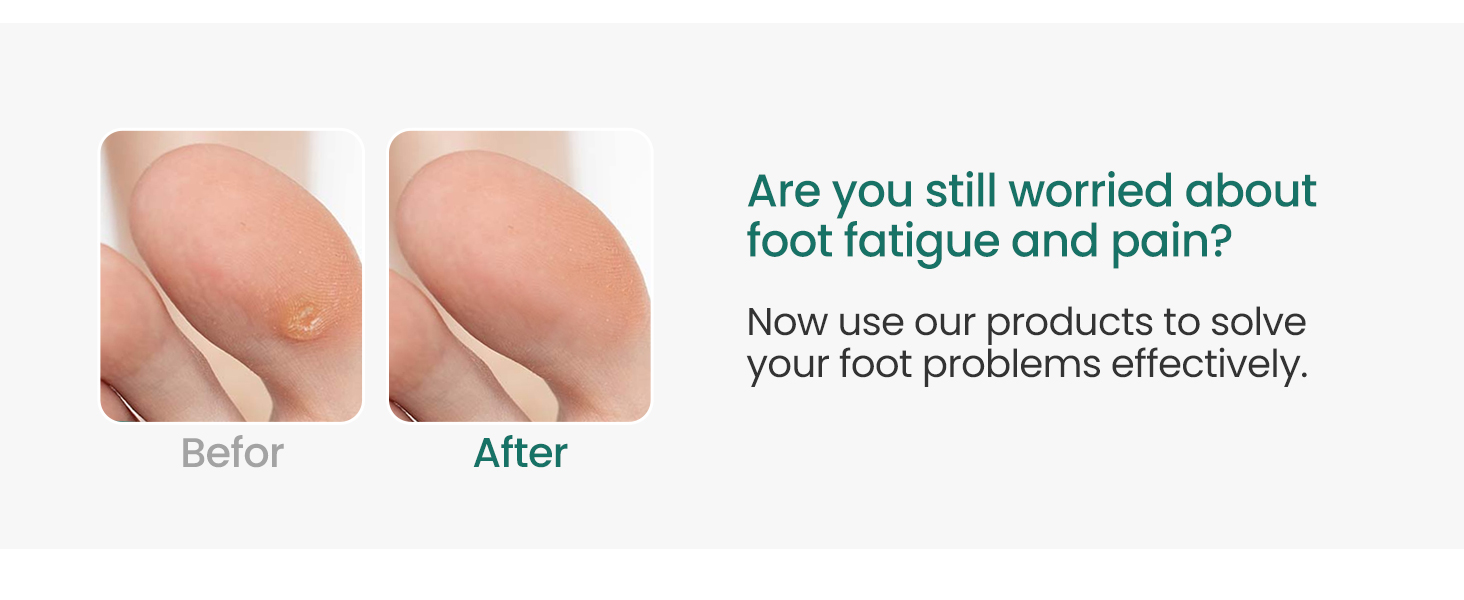 corn cushions for toes