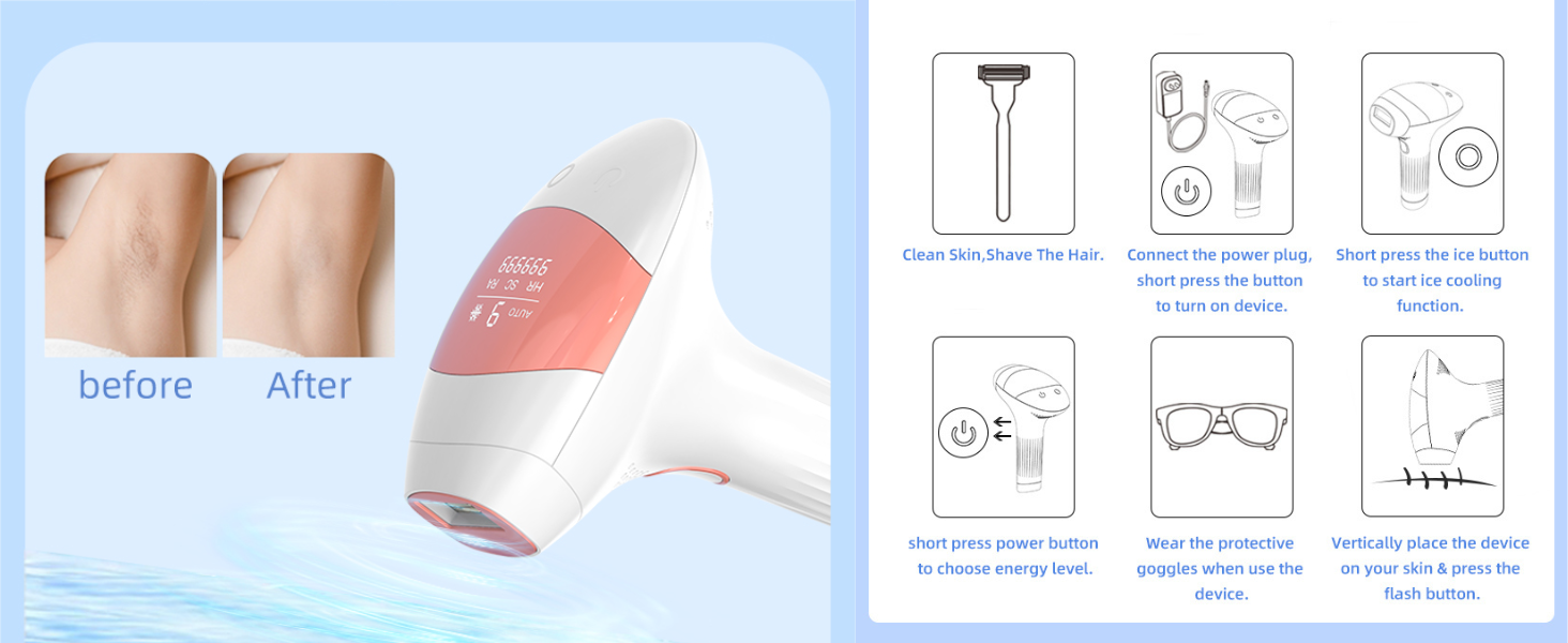 innza laser hair removal