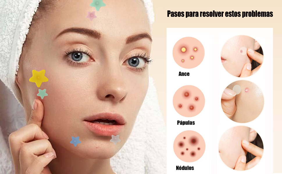 Parches para Acne