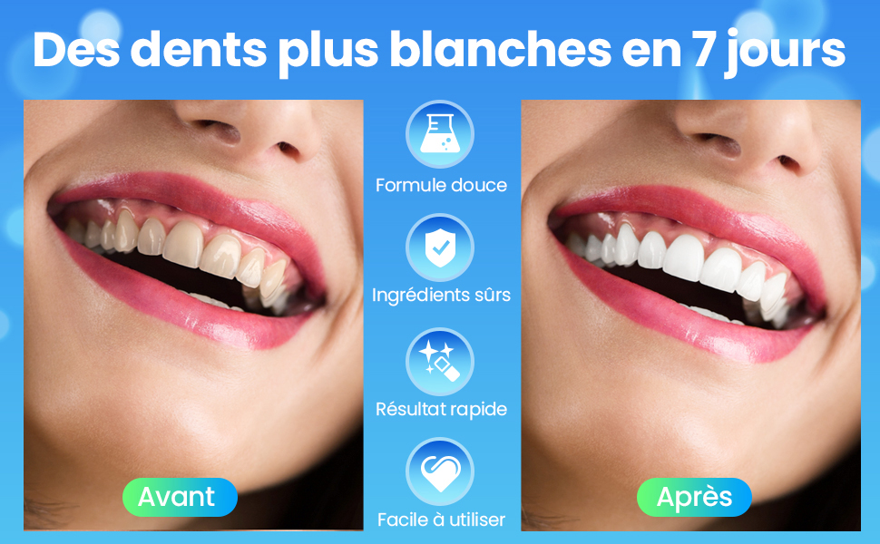 Des dents plus blanches en 7 jours