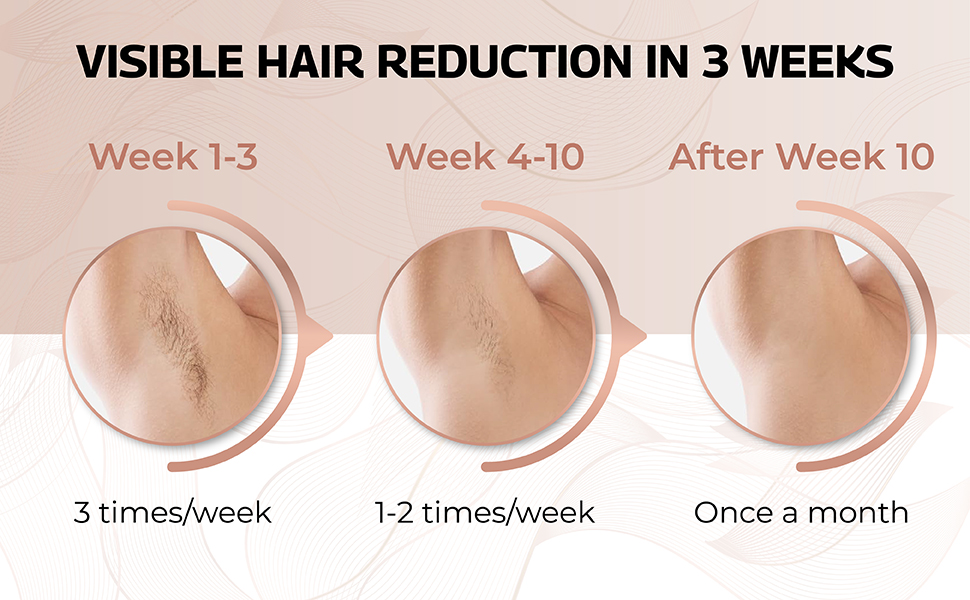 At Home IPL, Epilator, At Home Laser, At Home IPL, Laser Hair Removal For Men, 