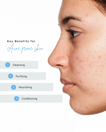 Acne prone skin