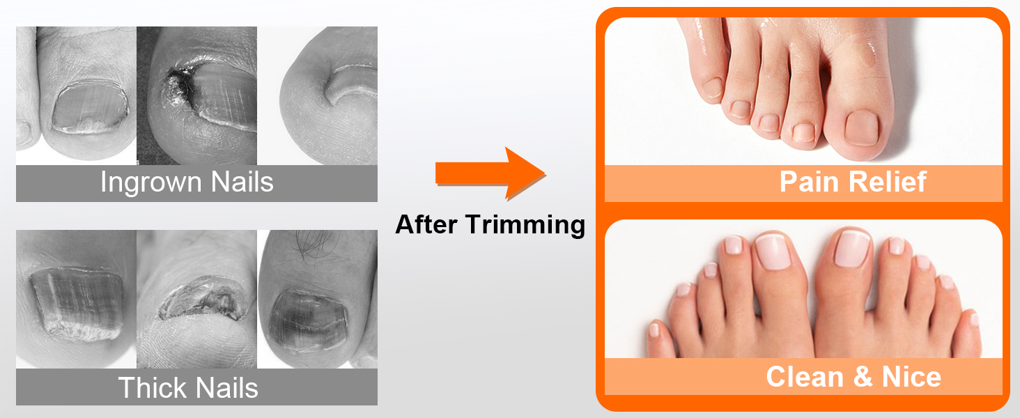 Toe Nail Clippers