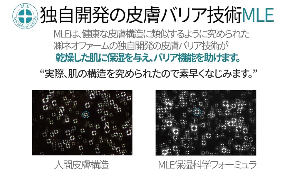 mle1