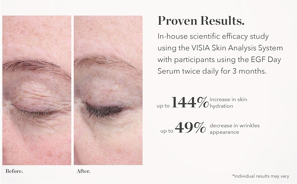 Proven Results Day Serum for Anti-Aging, Anti-Wrinkles & Visibly Reducing Fine Lines Before After