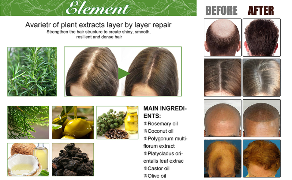 rosemary oil