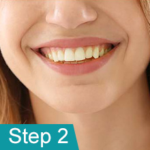 fake teeth