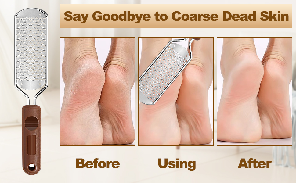 Foot File Callus Remover