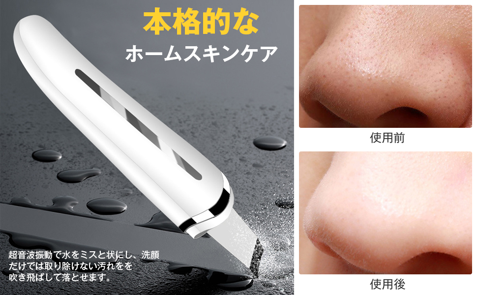 美容家電 楽天市場】ウォーターピーリング 美顔器 リフトアップ 1台4役 超