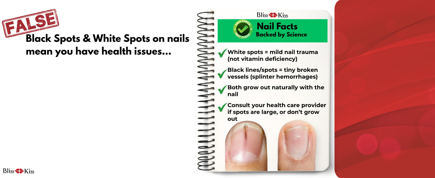 spots on nails nail care simply pure cuticle nail oil pen nail strengthener nail growth serum