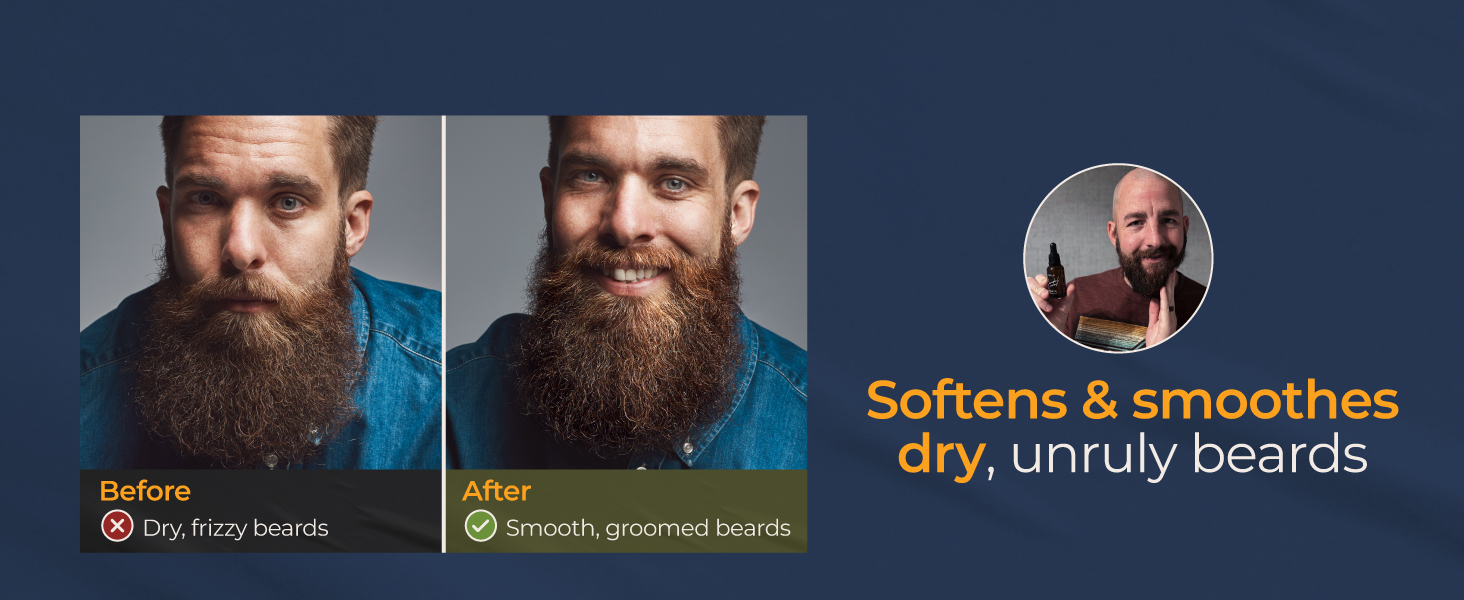 beard conditioners & oils beard fast growth oil beard growth organic care oil beard oil dandruff