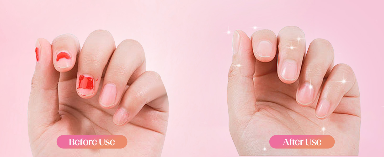 electric callus remover for feet