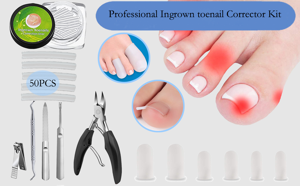 Ingrown Toenail Corrector