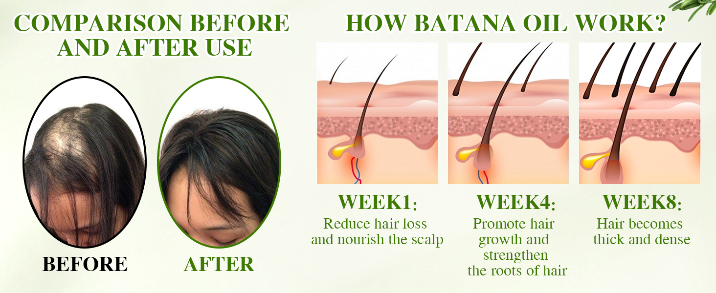 batana oil for hair growth