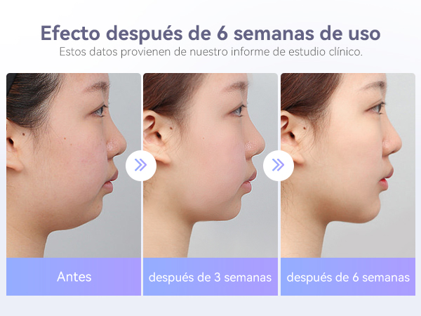 ANLAN Reductor de Papada Lifting V-Face, EMS Masajeador Facial Shapping con Caliente, Lifting y Reafirmante con Fototerapia Roja y Azul, 6 Modos : Amazon.es: Belleza