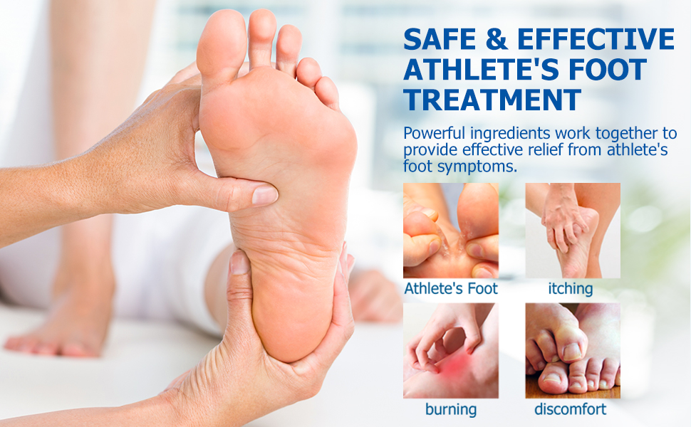 atheletes foot Treatment