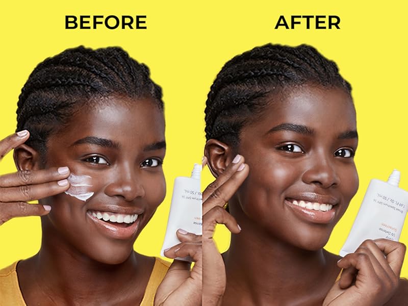 Before and After