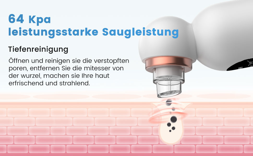 electric blackhead remover