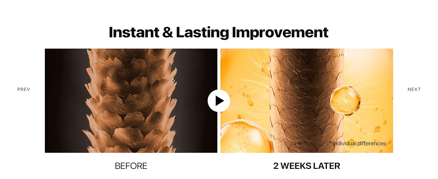 Instant & Lasting Improvement