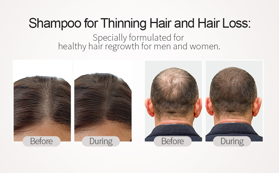 biotin shampoo for hair growth