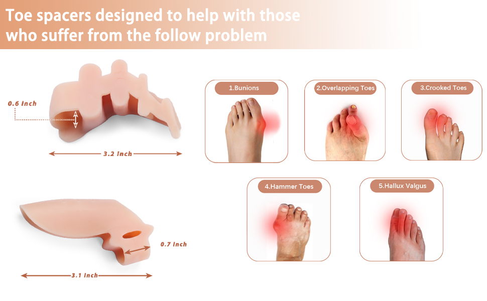 Toe Separators