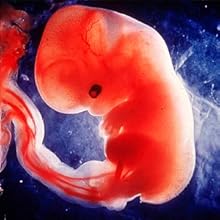 Human embryo
