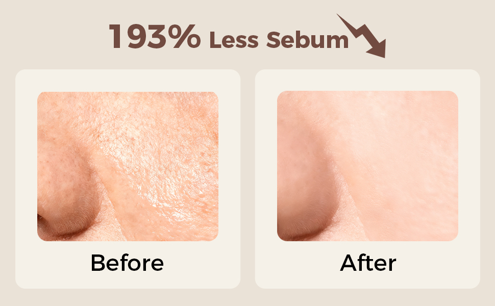 193% Less sebum