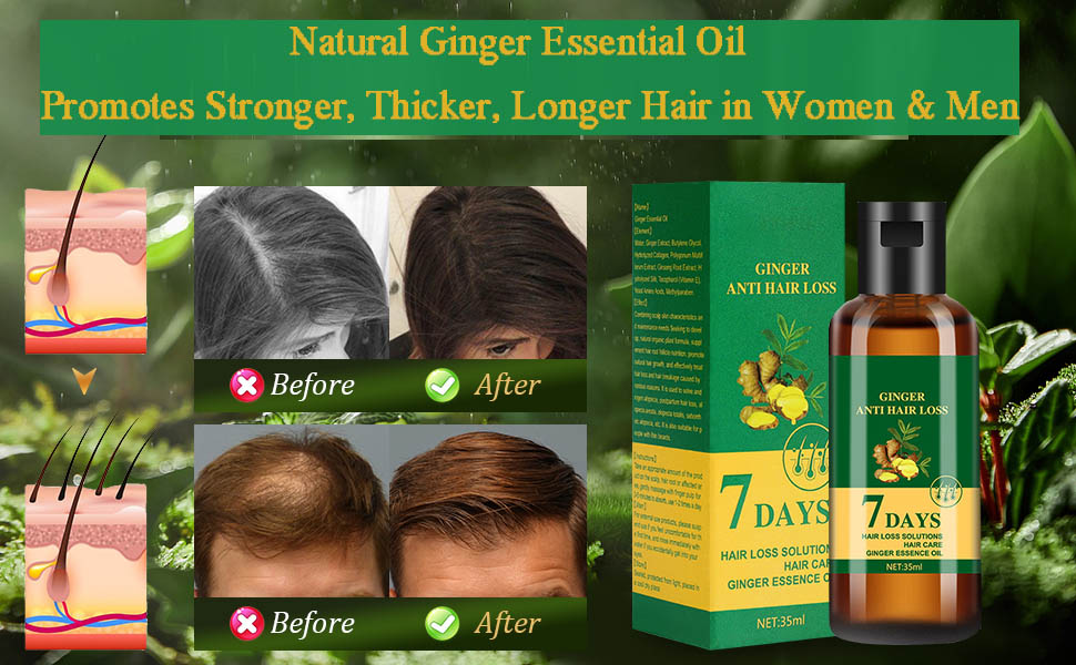 Effectively Strengthen Hair Roots Ginger Oil For Hair Growth