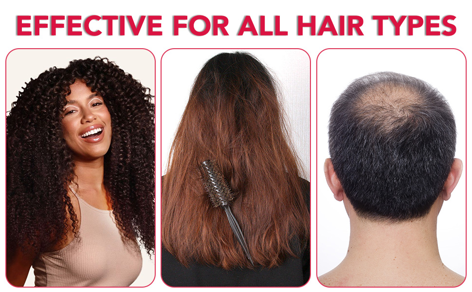 Suitable for all hair types