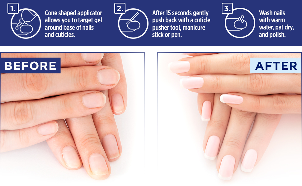 jojoba oil vitamin e stretch marks conditioner shampoo sensitive skin hypoallergenic softener gel