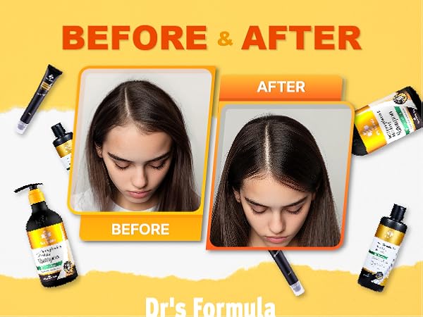 スタイリング剤 Dr.SYS BEST SCALP SERUM スタイリング剤 Dr.SYS BEST SCALP SERUM スカルプセラム