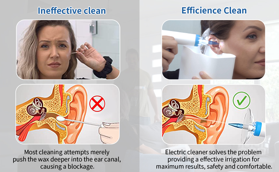 Electric Earwax Removal Ear Irrigation System Electric