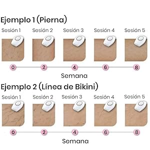 depiladora laser ipl