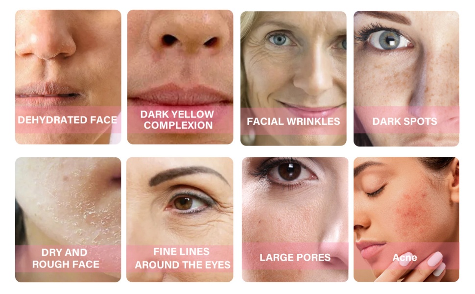 face moisturiser for dry skin face moisturizer hydrating moisturiser hydrating face creamantiredness