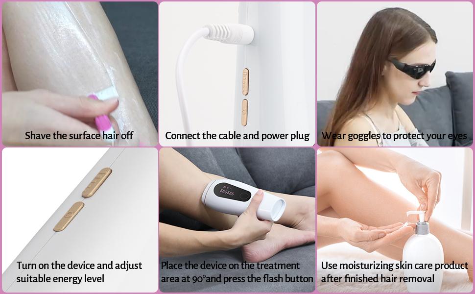 IPL Hair Removal