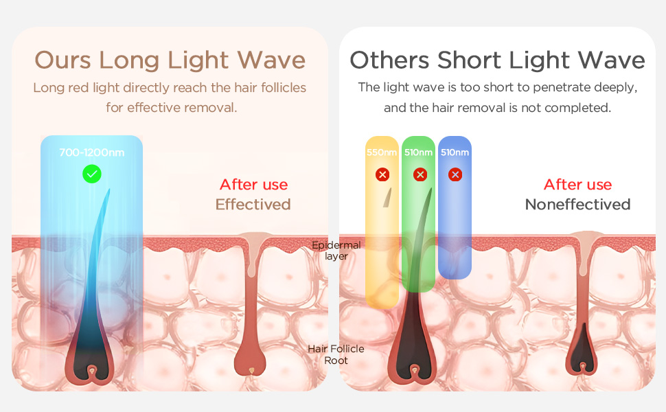 hair removal laser device