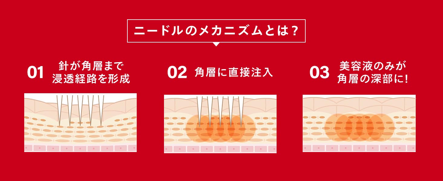 リンクルインジェクション