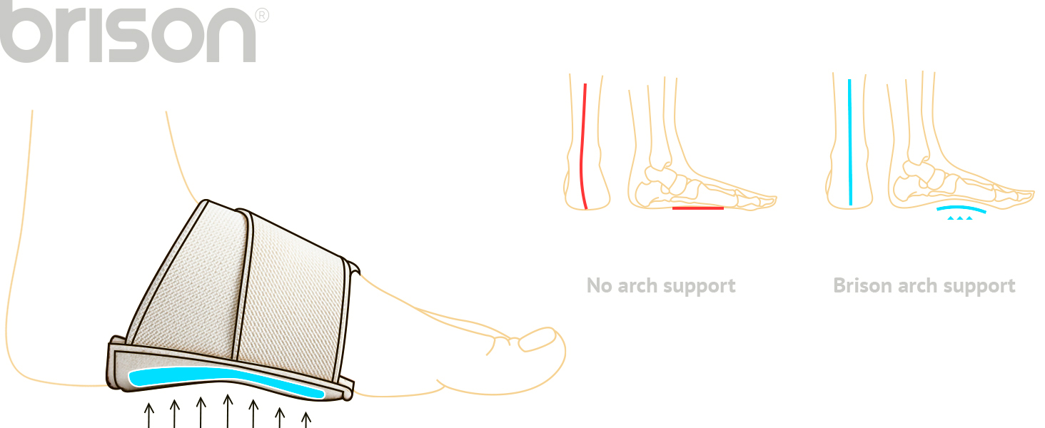 Arc support benefits