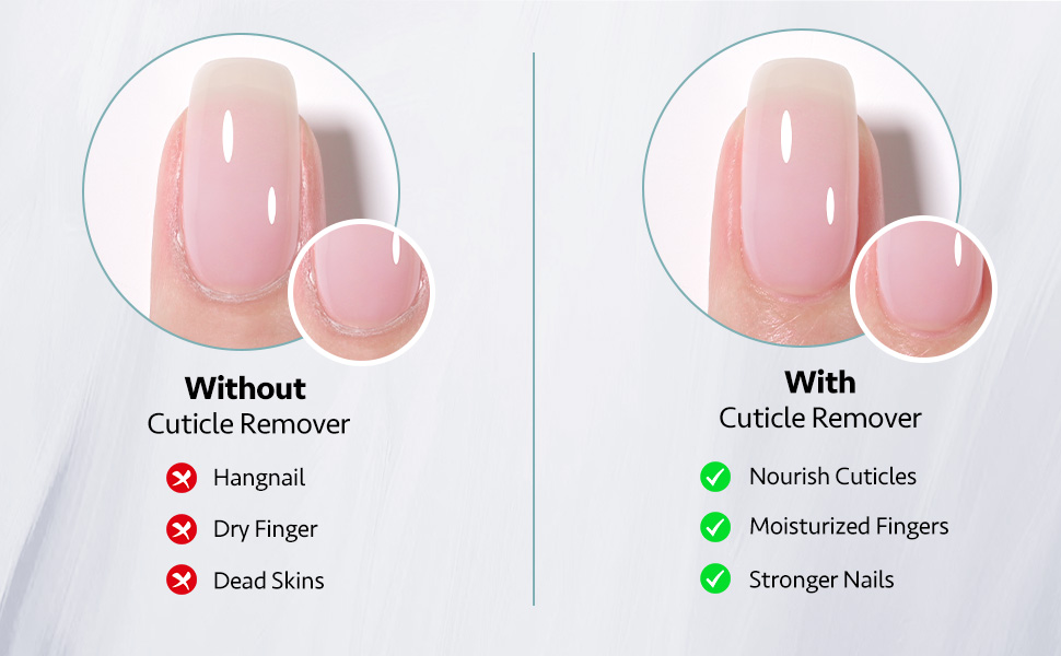 Cuticle Remover