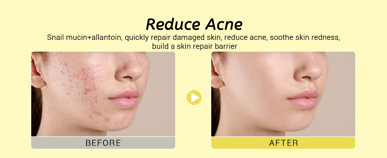 snail mucin skin care set