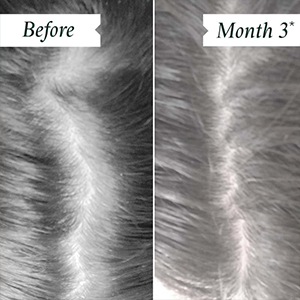 Density Hair and Scalp Preserving Collection