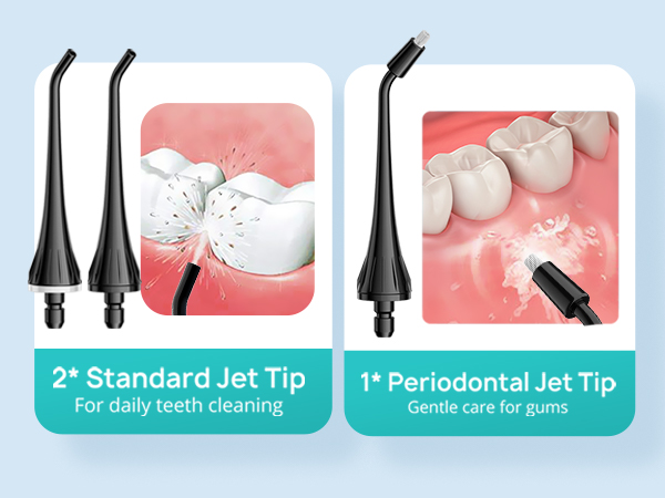 Dental water flosser tips diagram showing two black nozzles: 2 standard jet tips for daily cleaning and 1 periodontal tip for gum care.