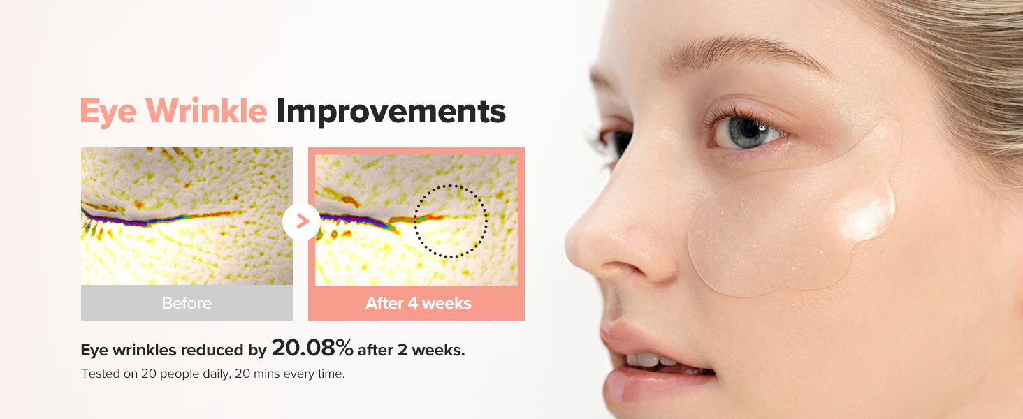 eye wrinkle improvements