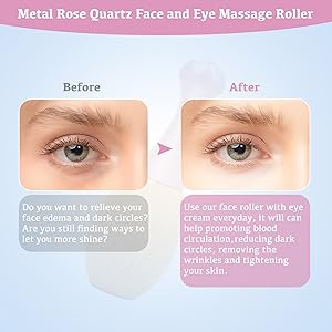 eye massager