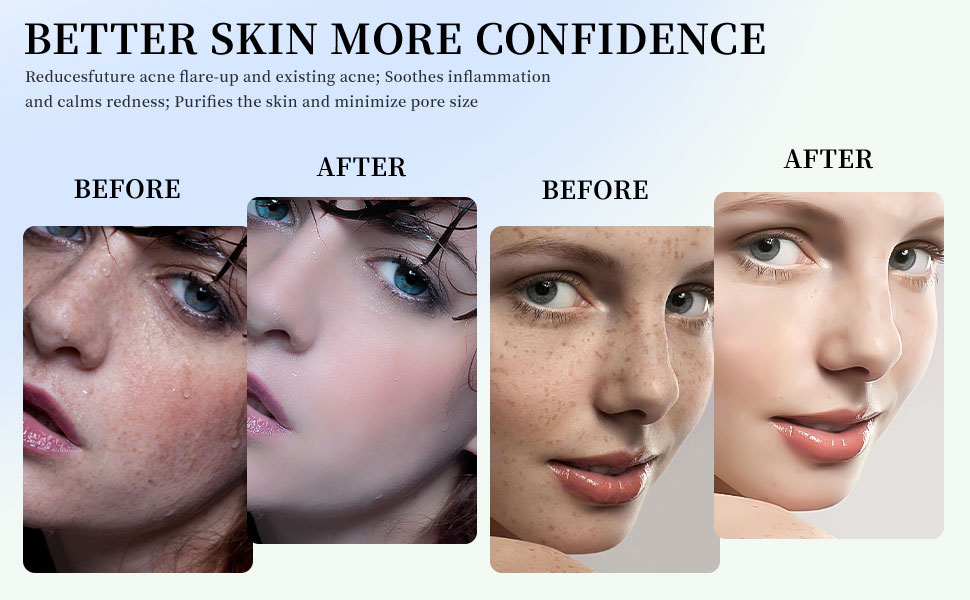 Buy ENLIWISH LED Face Mask Light Therapy, Illuminate Your Skin 7 Colors